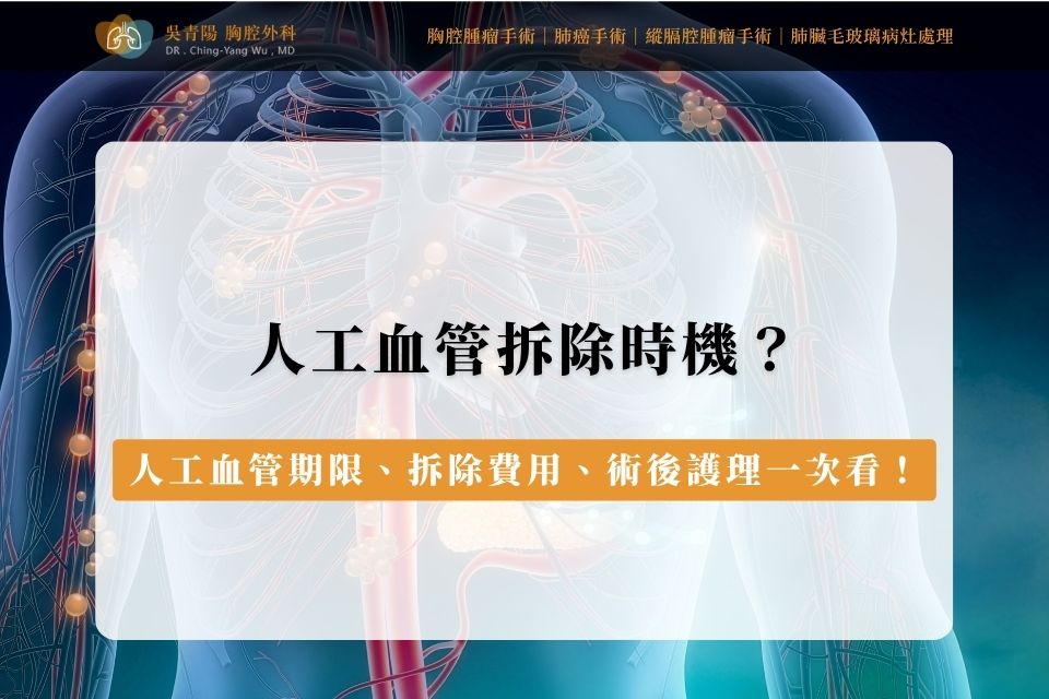 人工血管拆除時機？人工血管期限、拆除費用、術後護理一次看！