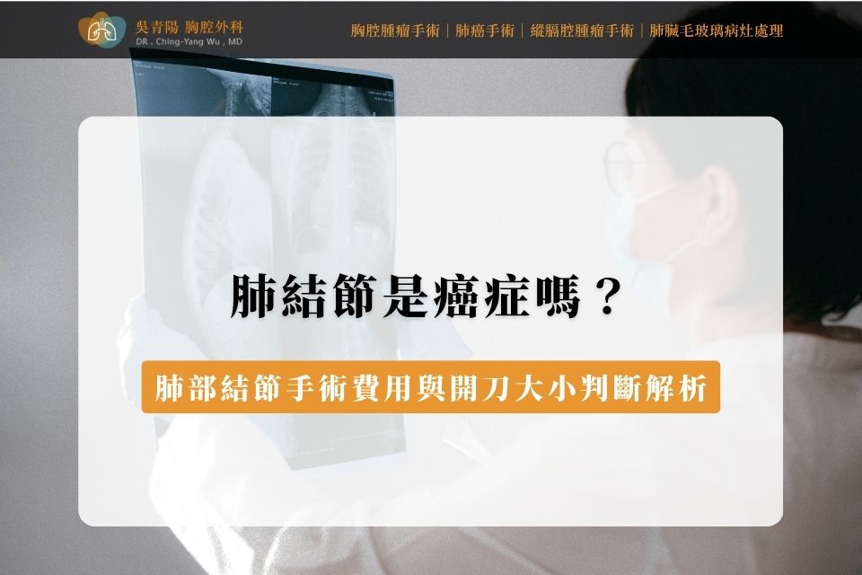 肺結節是癌症嗎？肺部結節手術費用與開刀大小判斷解析