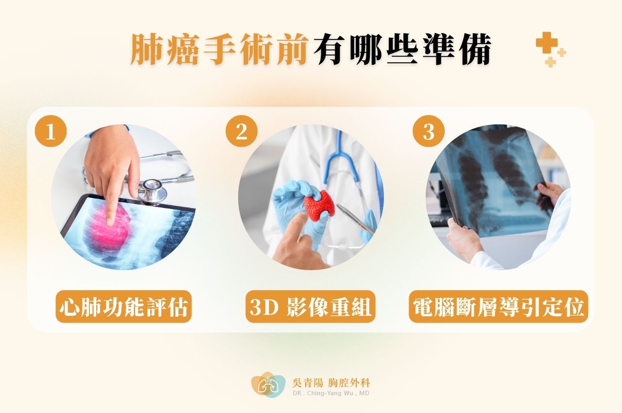 肺癌手術前要進行哪些準備？